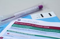 Swab Test for Women