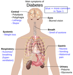 Diabetes symptoms body