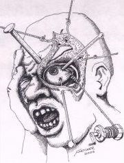 Cluster headaches - torture