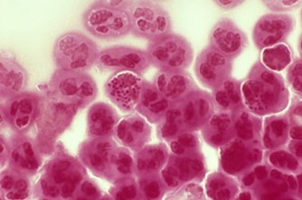Stained cells